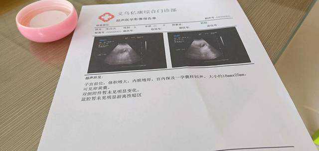 广州代孕服务-广州世纪代孕价格表
