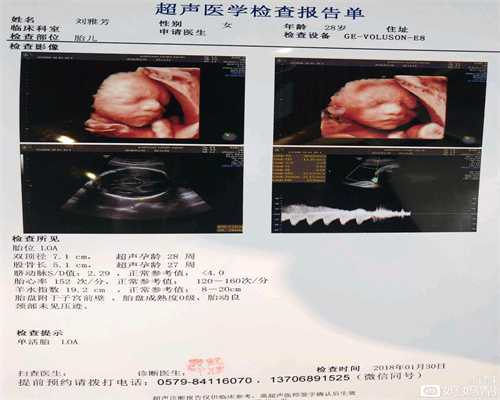 广州有关代孕的公司_广州多囊卵巢最快受孕方法