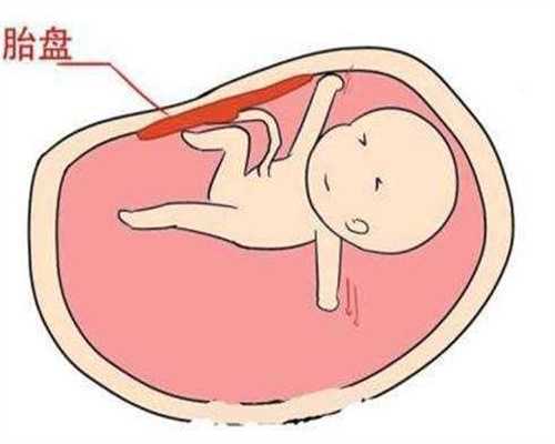 汕尾代孕_汕尾哪里有代孕_多囊卵巢综合征月经期