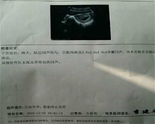 广州代怀孕多少钱-泾川县泰国第三代试管婴儿