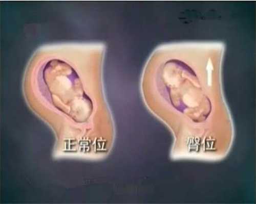 广州代孕后怎么上户口_广州代孕医院多少钱_特异