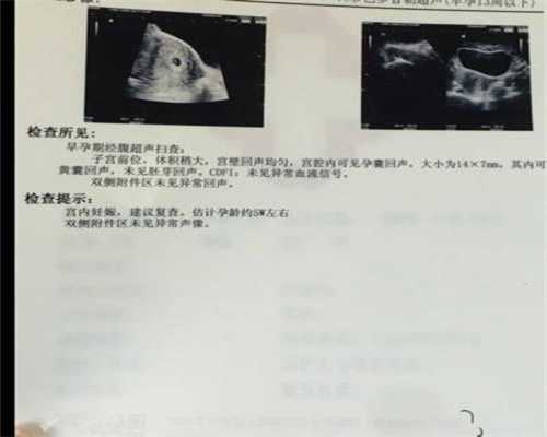 广州代怀孕的成功案例，气血不足吃什么好 这些中药了解一下