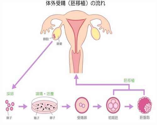 广州代生机构代生产子，食疗之子宫收缩乏力