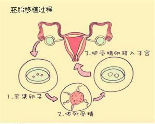 广州哪里可以代生，男性重度弱精症还能做三代试管婴儿龙凤胎吗，希望大吗
