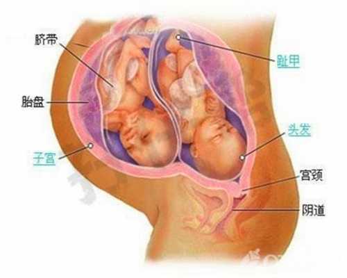 广州供卵试管婴儿怎么申请，上海国际医学中心向大家解释试管婴儿移植后胚胎